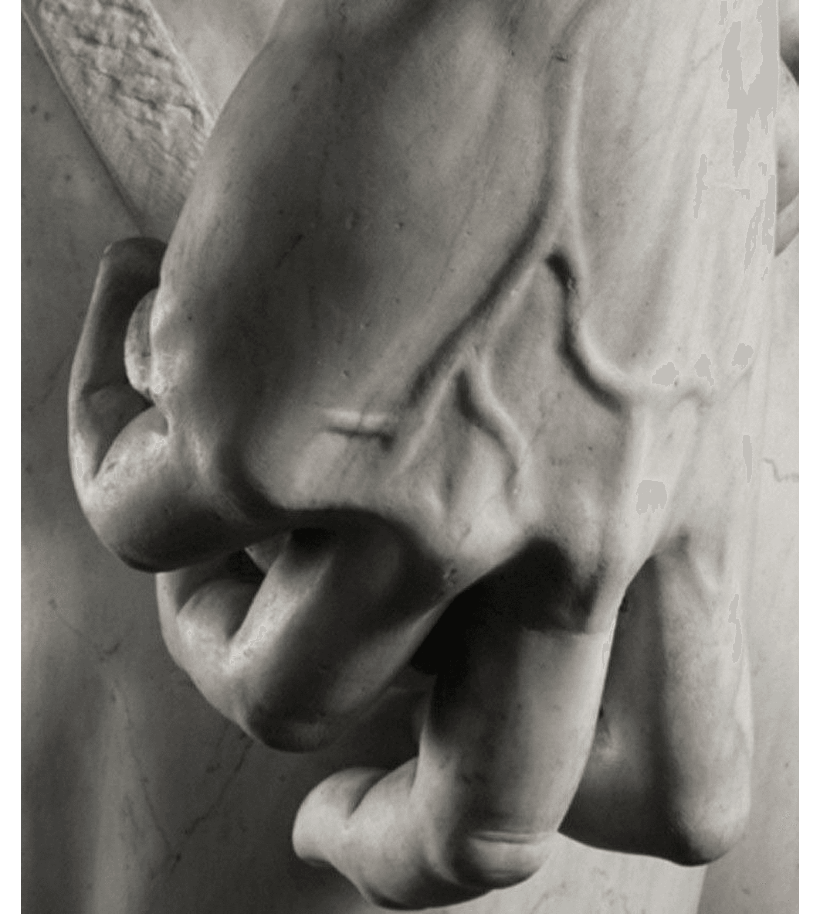 Судинна хірургія